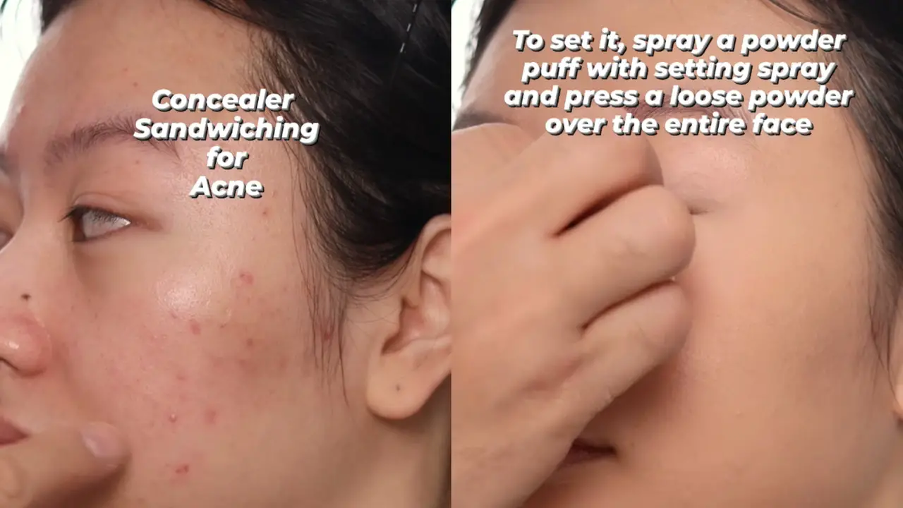 How to Cover Acne With Makeup? Try Concealer Sandwiching