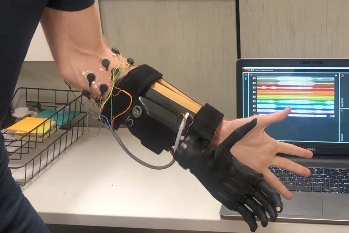 Prosthetic hands are easier to control using unrelated muscles