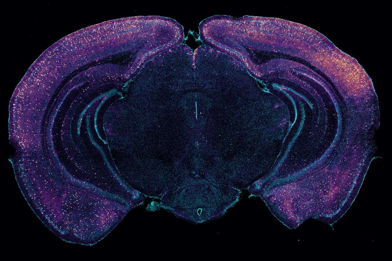 Light and sound may slow Alzheimer’s by making the brain remove toxins