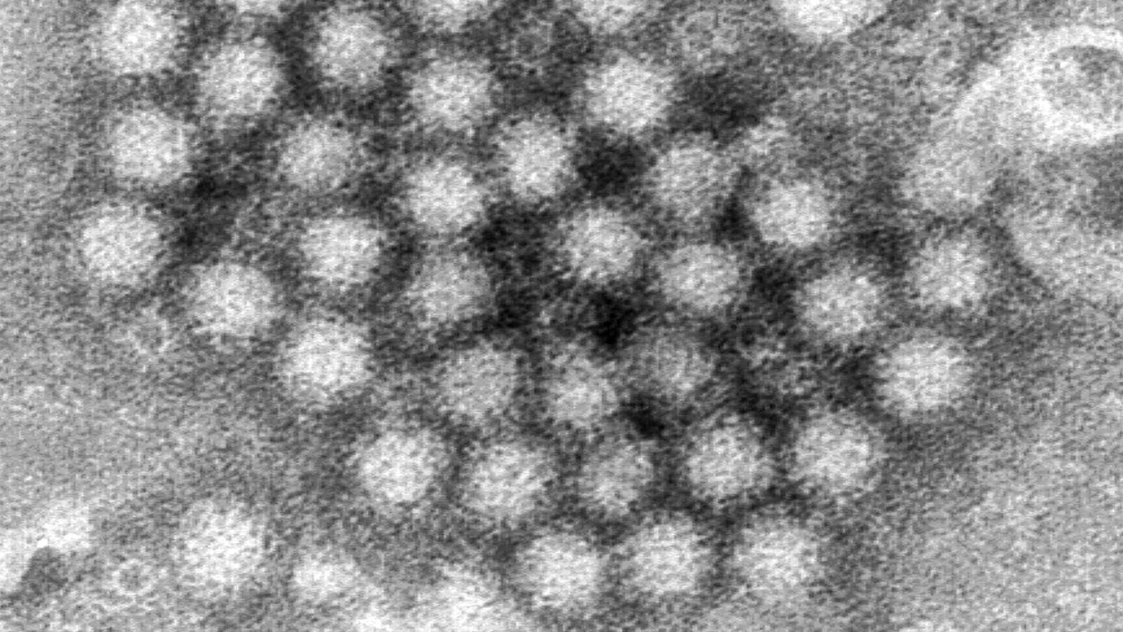 Nasty norovirus is back in full force with US cases of the stomach virus surging